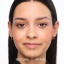 98379-website__format_jpg-28081_brow-lift-lamination_before_after_en.jpg
